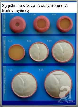 Nở 2 phân bao lâu thì sinh? Gallery 1