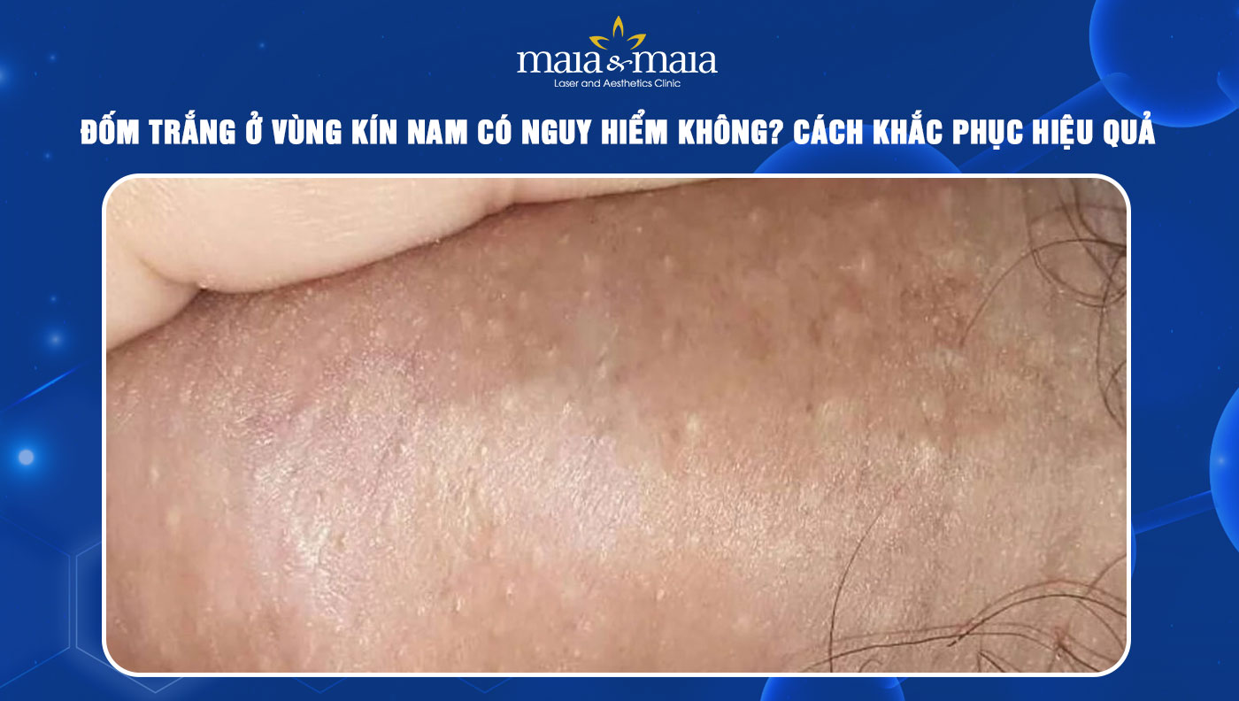 Nổi Đốm Trắng Ở Vùng Kín Nam: Nguyên Nhân Và Cách Điều Trị