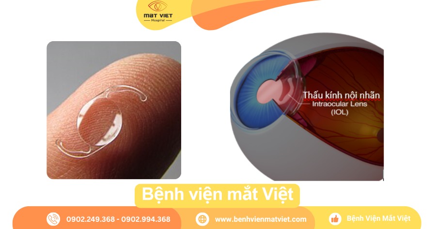 Nói lệch là gì?