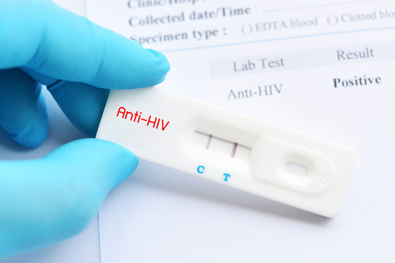 Xét nghiệm HIV ở đâu, bao nhiêu tiền? Gallery 1