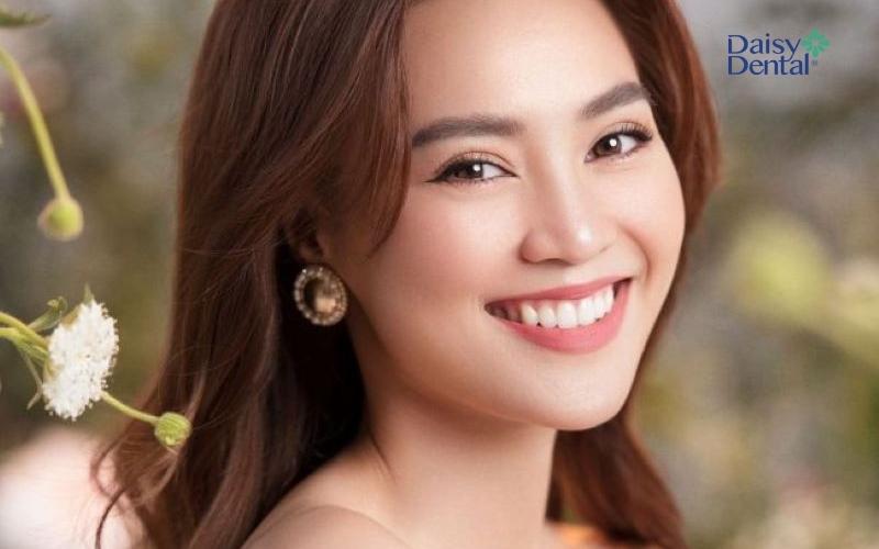 Nụ Cười Đẹp Nhất: Bí Quyết Cho Răng Mịn Màng Và Gương Mặt Tỏa Sáng Gallery 2