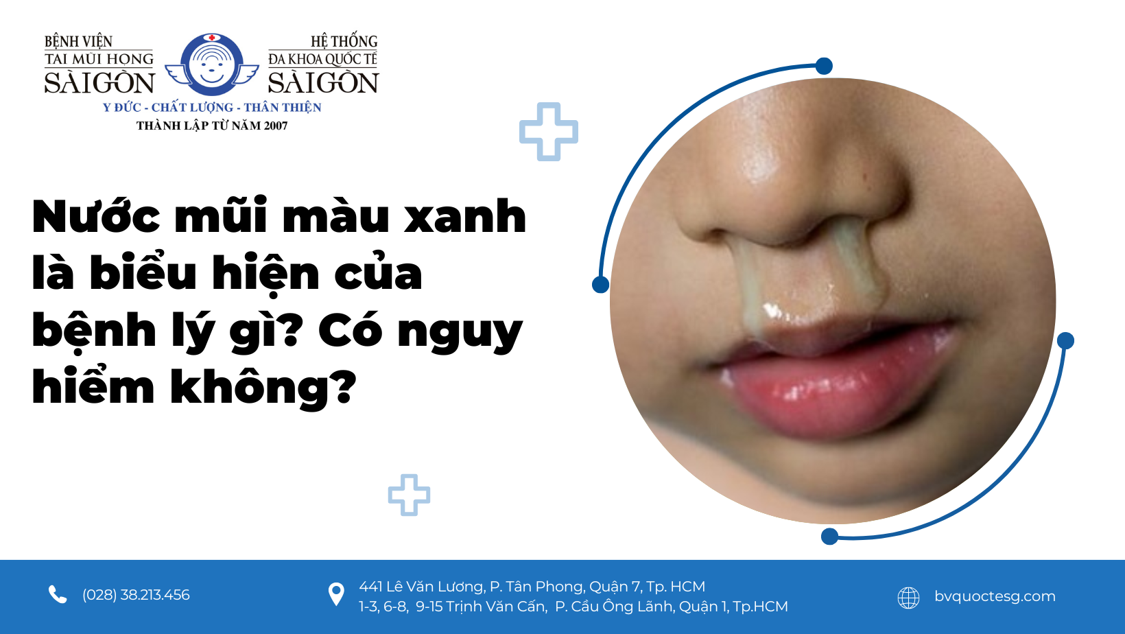 Nước mũi màu xanh có mùi tanh: Nguyên nhân và cách xử lý