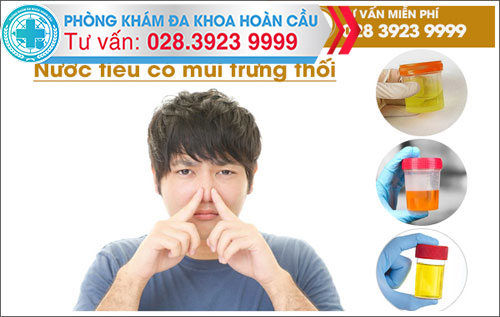 Nước Tiểu Có Mùi Hôi Trứng Thối: Nguyên Nhân và Cách Khắc Phục