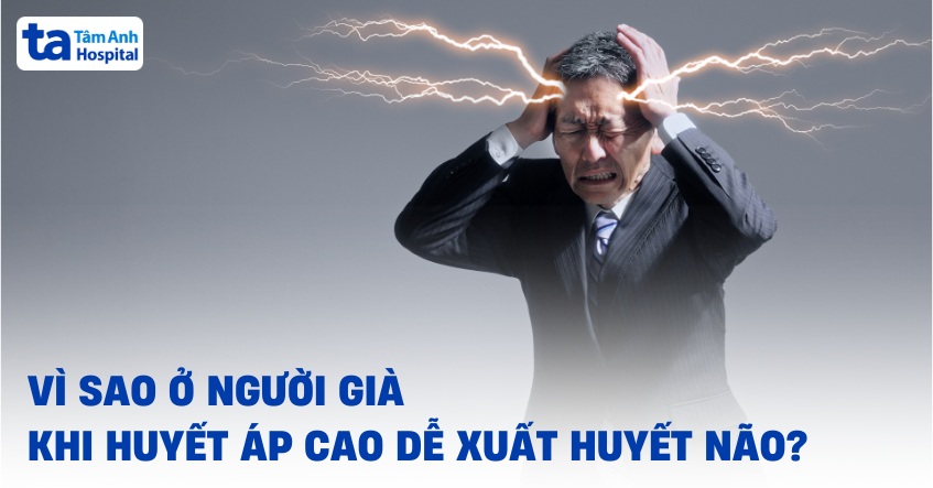 Người già huyết áp cao dễ bị xuất huyết não vì sao?