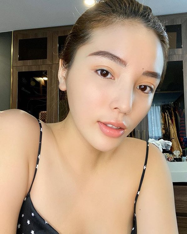 Ốm nhưng không có xương quai xanh