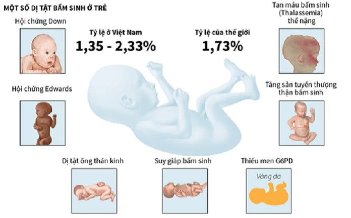 Dị tật bẩm sinh là gì? Gallery 2