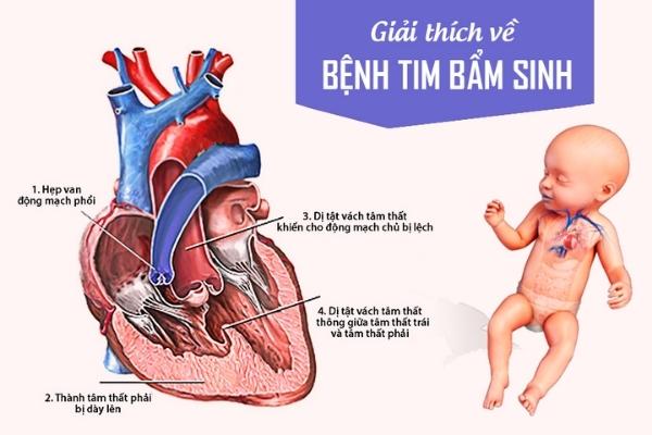 Dị tật là gì? Gallery 1