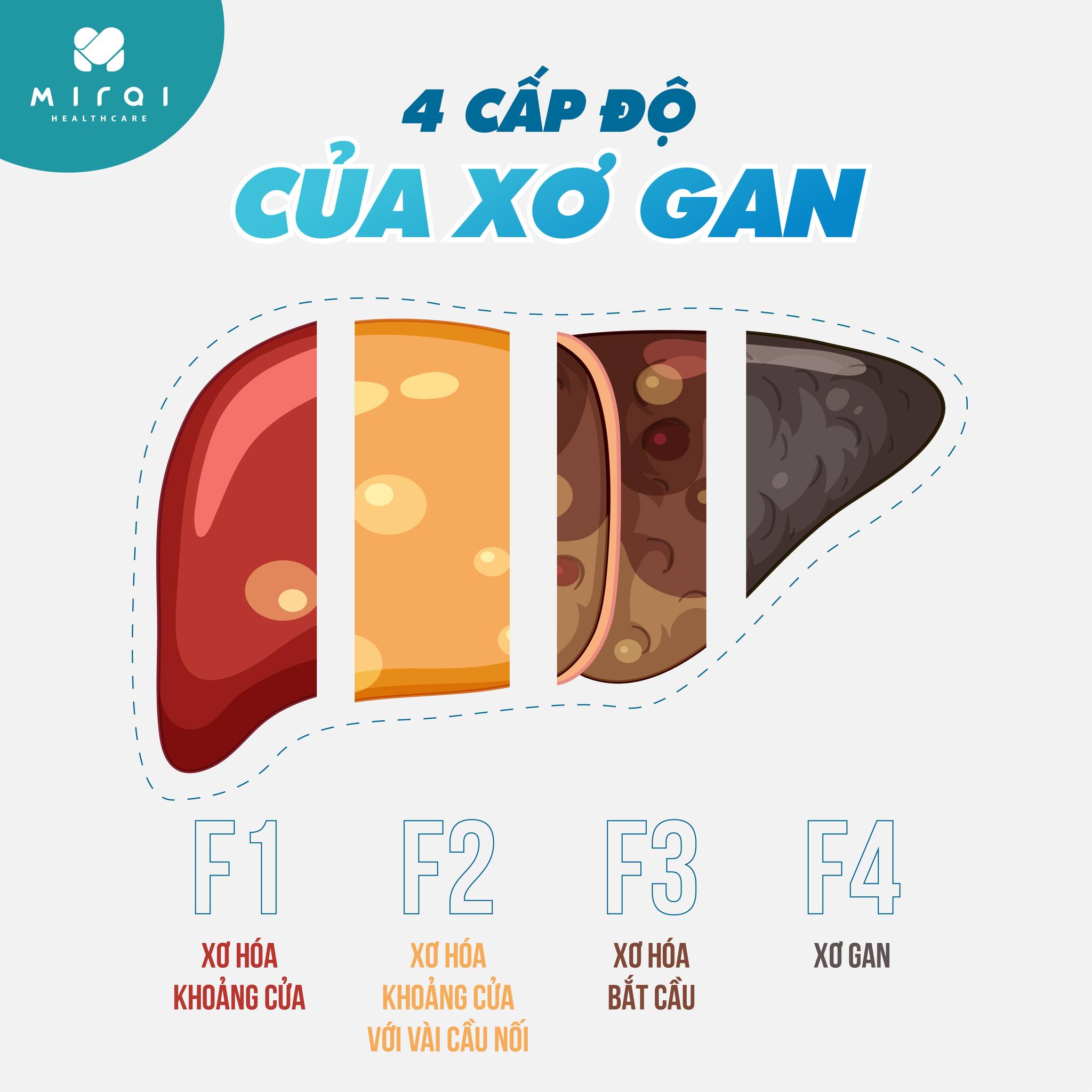 Xác xơ là gì? Gallery 1