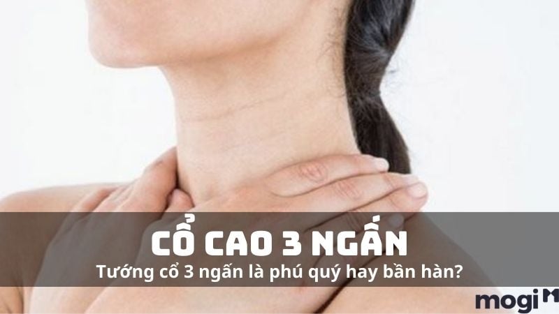 3 Ngấn La Trai Hay Gái? Gallery 1