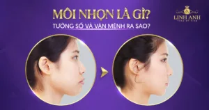 Tướng Môi Trên Nhô Ra: Ý Nghĩa, Đặc Điểm Và Phân Tích Gallery 2