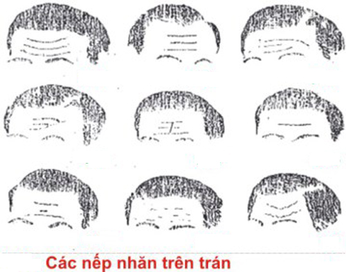 Tướng Nếp Nhăn Trên Trán: Giải Mã Bí Ẩn Qua Đường Nếp Nhăn Gallery 1