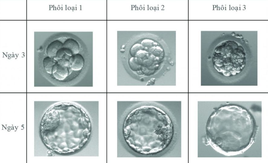 Phơi Phới Là Gì? Gallery 2