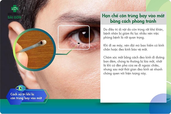 Côn trùng bay vào mắt gây đau rất nhiều: Cách xử lý và phòng ngừa Gallery 2