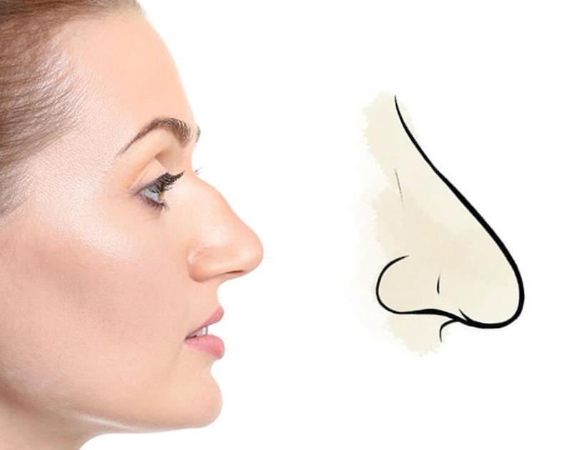 Phụ nữ mũi khoằm: Điểm mạnh, nét đẹp và cách khắc phục khuyết điểm