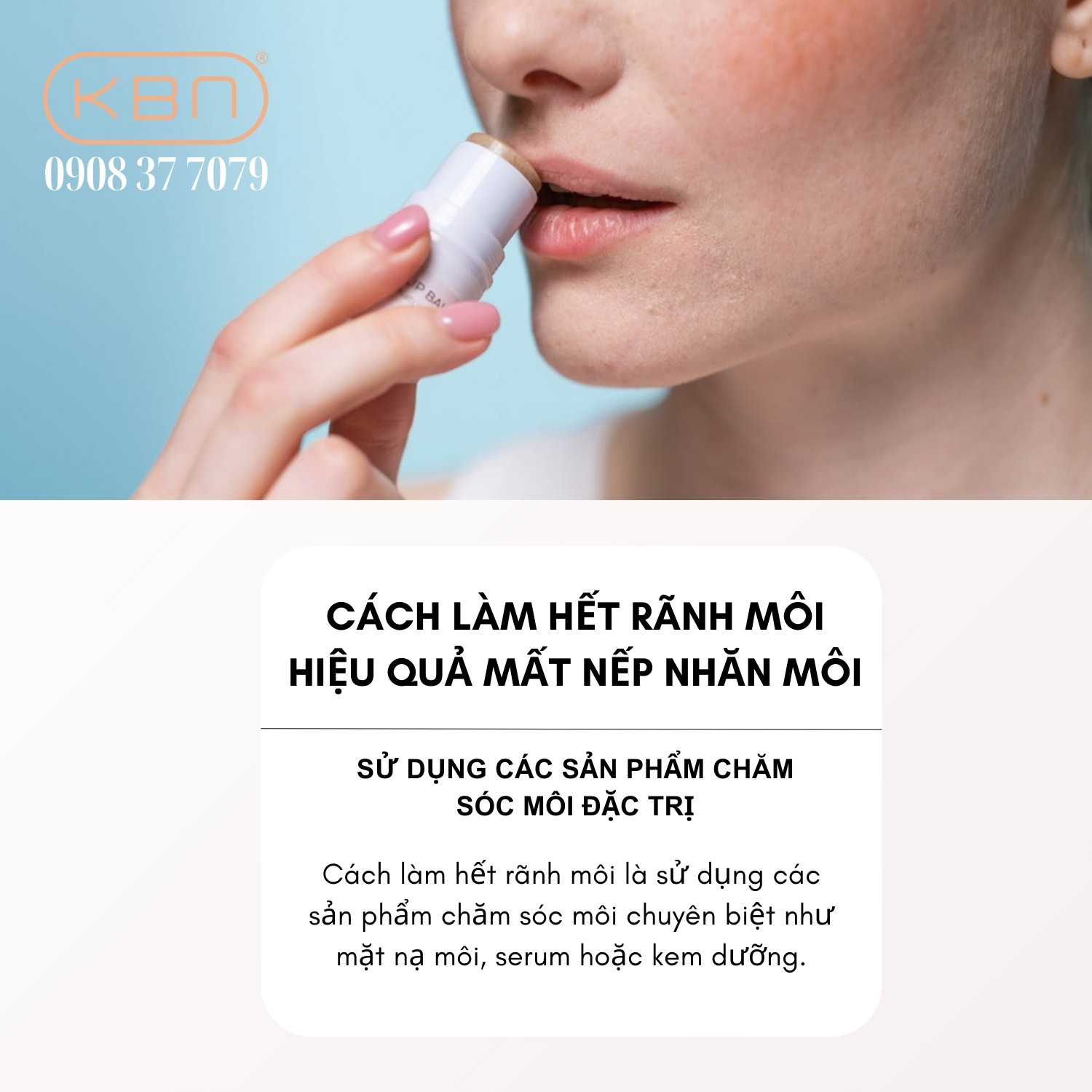 Cách Làm Hết Rãnh Môi Gallery 2