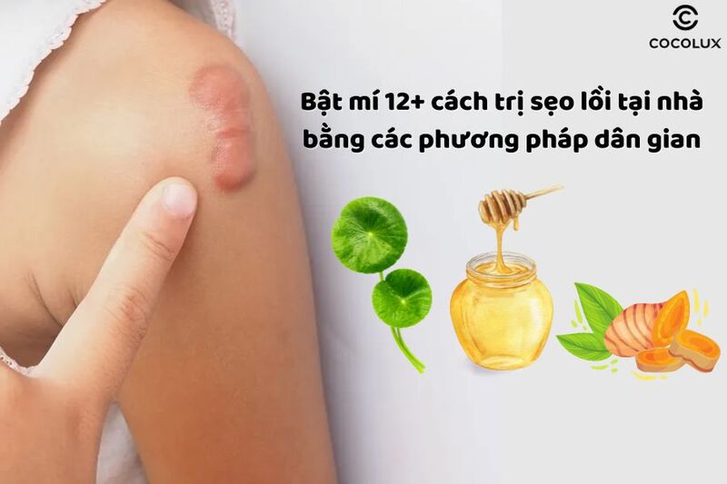 Cách Làm Hết Sẹo Lồi Hiệu Quả Gallery 1