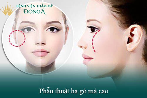 Cách Làm Mặt Đầy Đặn Hiệu Quả & An Toàn Gallery 2