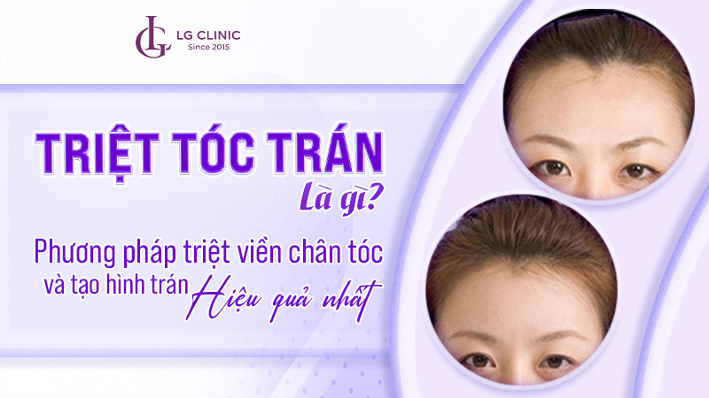 Triệt Tóc Tạo Trán Cao: Hướng Dẫn Chi Tiết & An Toàn Gallery 1