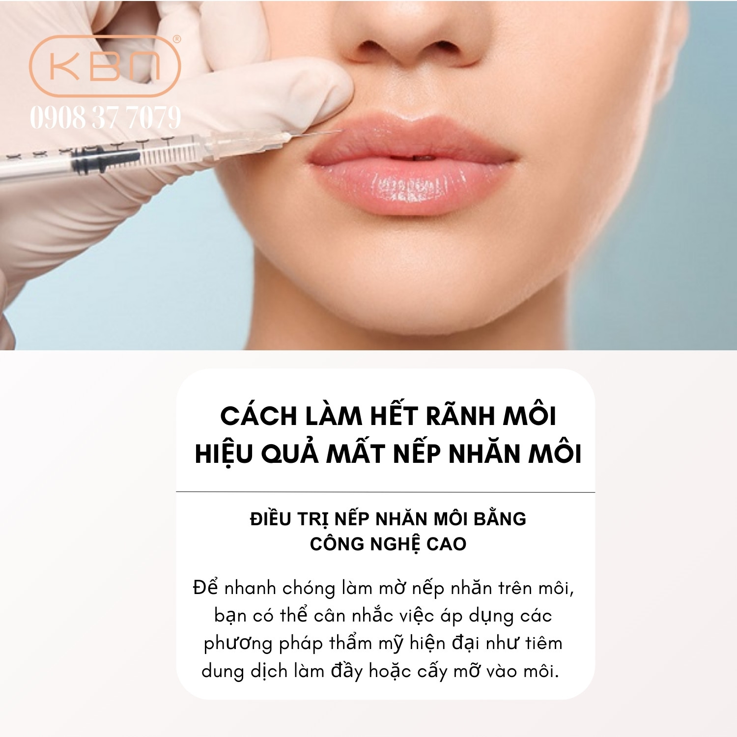 Cách Làm Hết Rãnh Môi Gallery 1