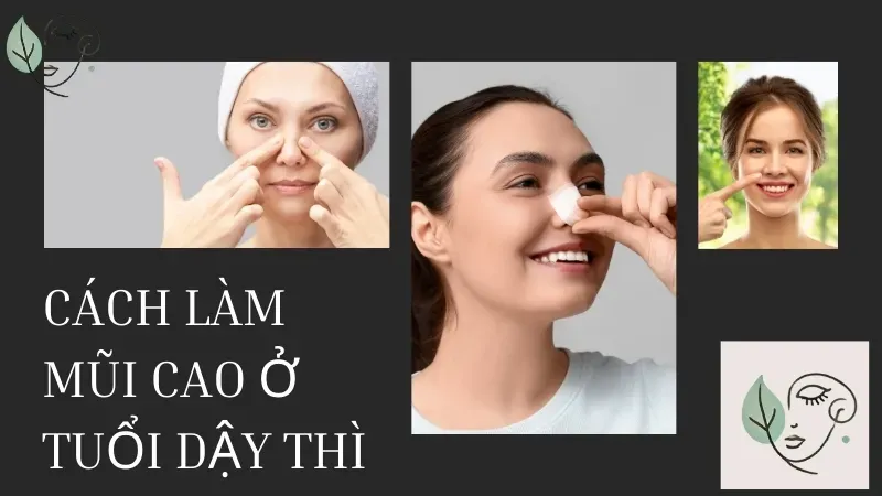 Cách Làm Mũi Nhỏ Ở Tuổi Dậy Thì Gallery 1