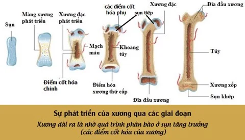 Chồi xương là gì? Gallery 1