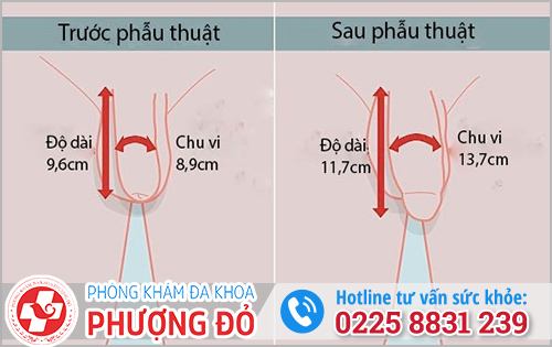 Chu vi dương vật Gallery 2