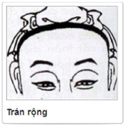 Trán rộng là như thế nào? Gallery 2