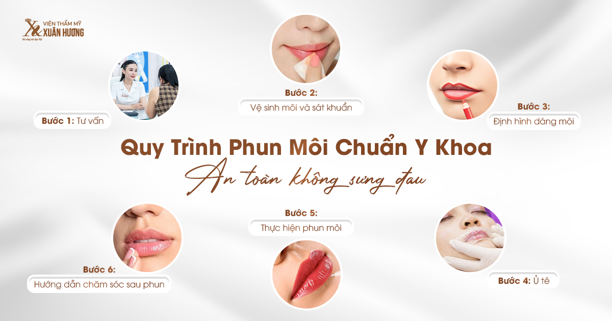 Phun môi: Hướng dẫn chi tiết từ A đến Z, giải đáp mọi thắc mắc Gallery 2