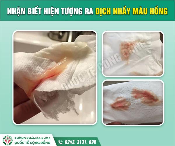 Khí hư màu hồng nhạt không mùi: Nguyên nhân và cách xử lý