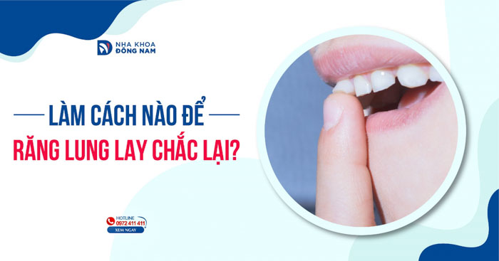 Răng lung lay làm sao để chắc lại?