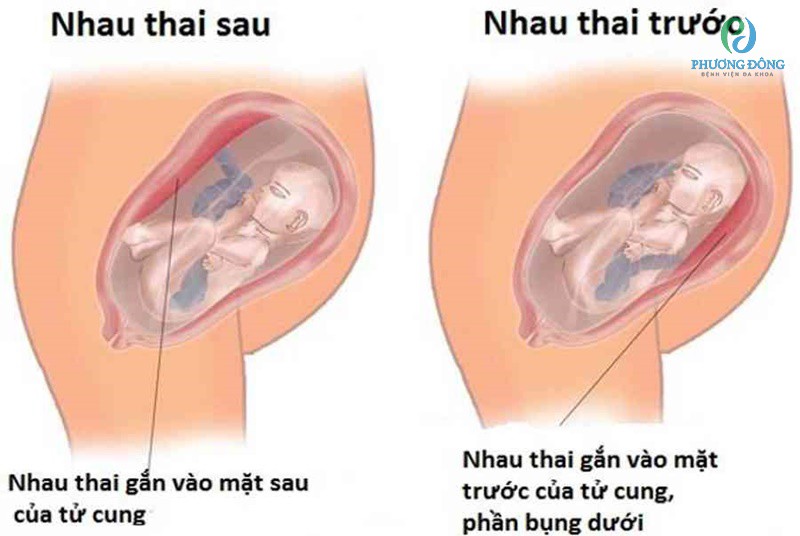 Rau bám rộng là tốt hay xấu?