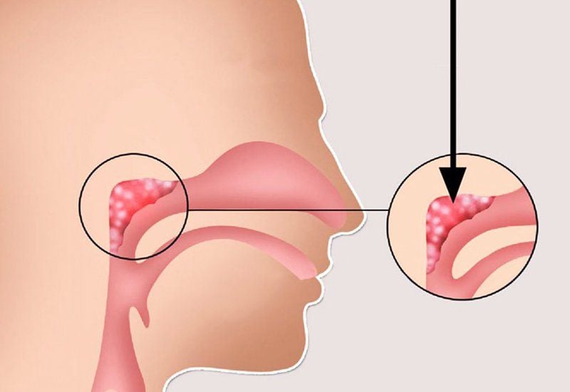 Có Nên Nạo Vét Cho Trẻ? Gallery 2