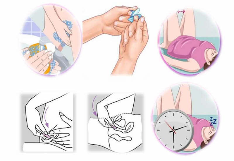 Thuốc Đặt Làm Thơm Vùng Kín: Có Thực Sự An Toàn và Hiệu Quả? Gallery 2