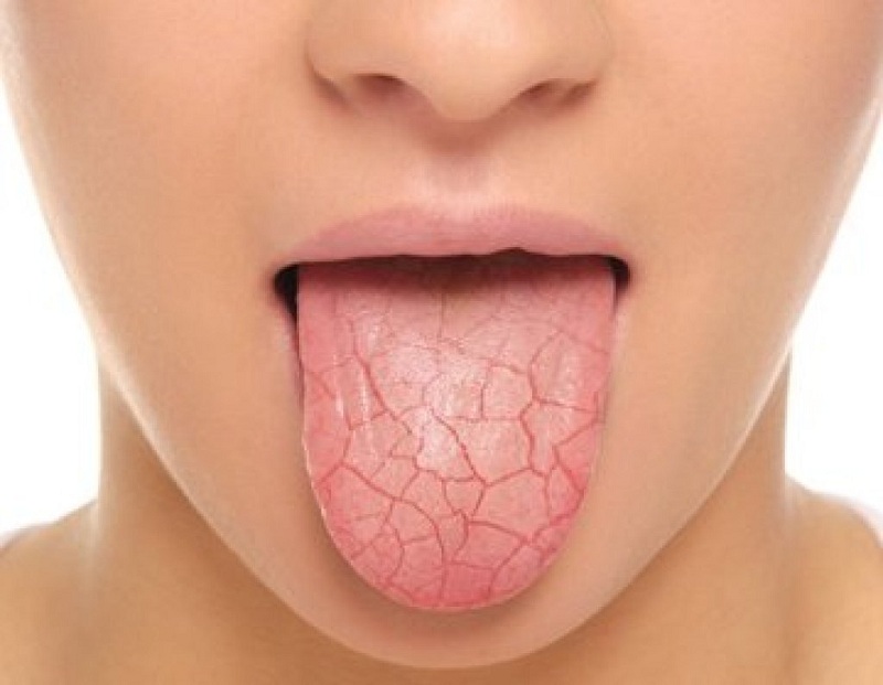Sáng Ngủ Dậy Bị Khô Miệng