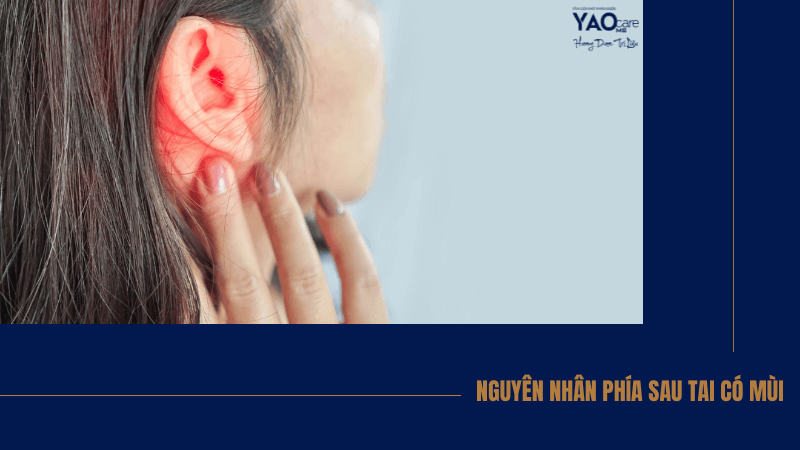 Sau vành tai có mùi hôi: Nguyên nhân và cách khắc phục