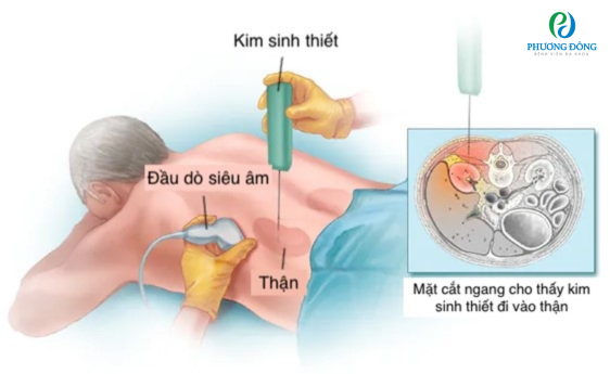 Sinh khiết là gì?