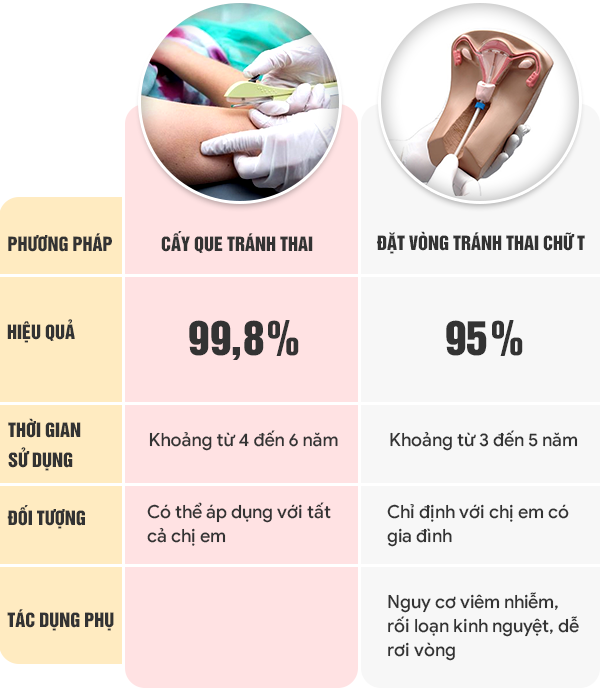 Cấy que hay đặt vòng tốt hơn? Gallery 1