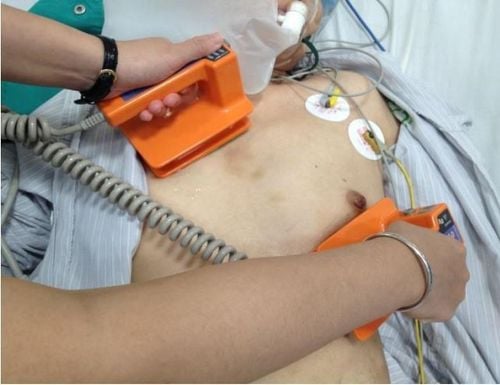 Sốc điện là gì?