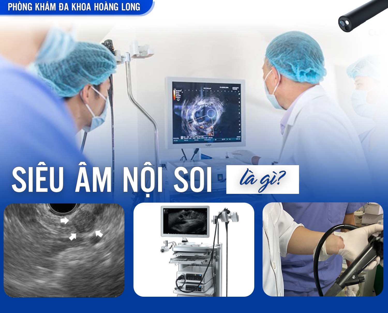 Soi Âm Là Gì?