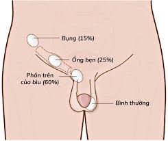 Kích thước bộ phận sinh dục bé trai 12 tuổi Gallery 1