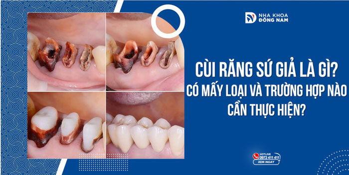 Sứ giả là gì?