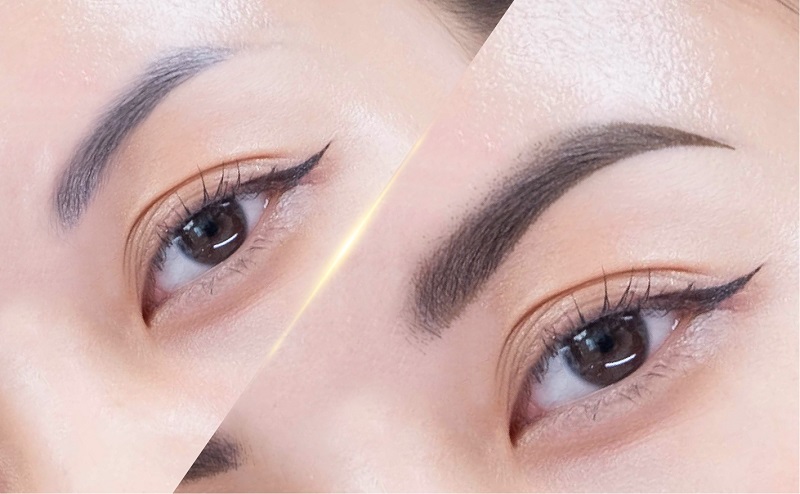 Đui Mắt Hay Đuôi Mắt? Gallery 1