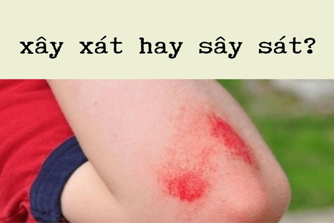Xây sát hay xây xát? Gallery 1