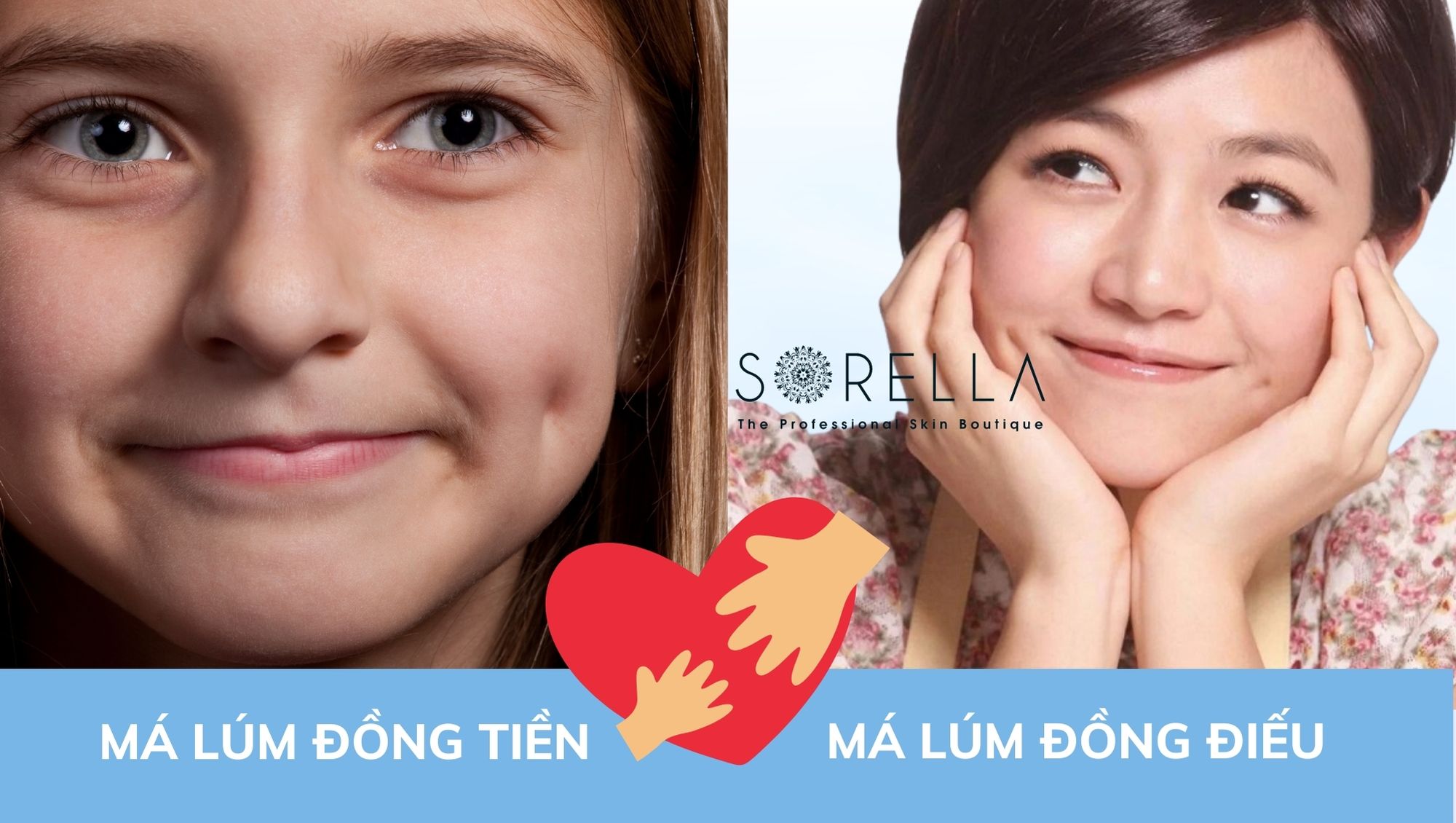 Lúm đồng tiền ở cằm: May mắn hay bất hạnh? Gallery 2