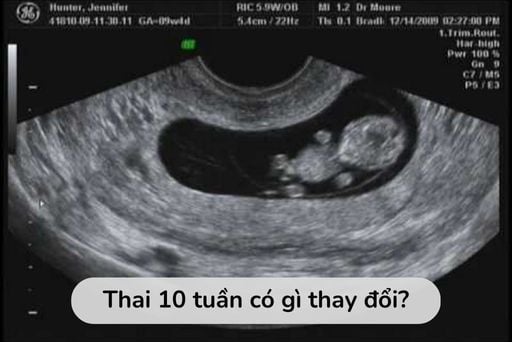 Thai nhi 10 tuần tuổi đã biết đạp chưa? Gallery 1