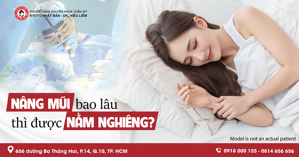 Sửa Mũi Bao Lâu Được Nằm Nghiêng?