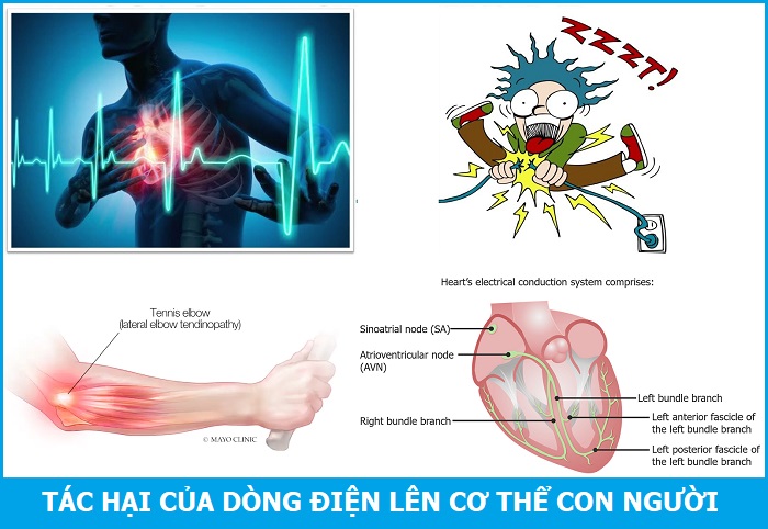 Tác dụng sinh lí của dòng điện Gallery 1