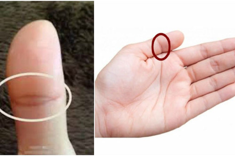 Ngón Tay Cái Có Mắt Phượng: Ý Nghĩa và Tác Động Đến Cuộc Sống Gallery 2