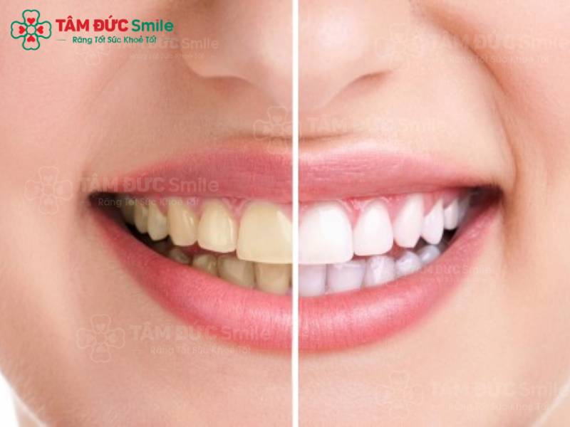 Ngậm dầu dừa có tác dụng gì? Gallery 1
