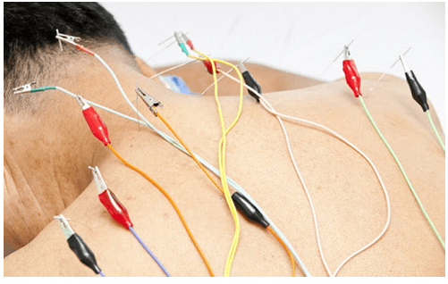 Tác dụng sinh lí của dòng điện